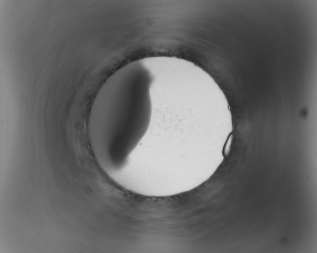 X0000115170817200911251332