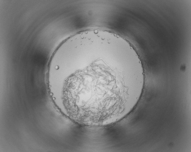 X0000115170856200911251332