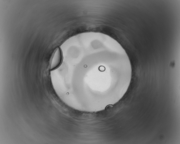 X0000115170914200911251330