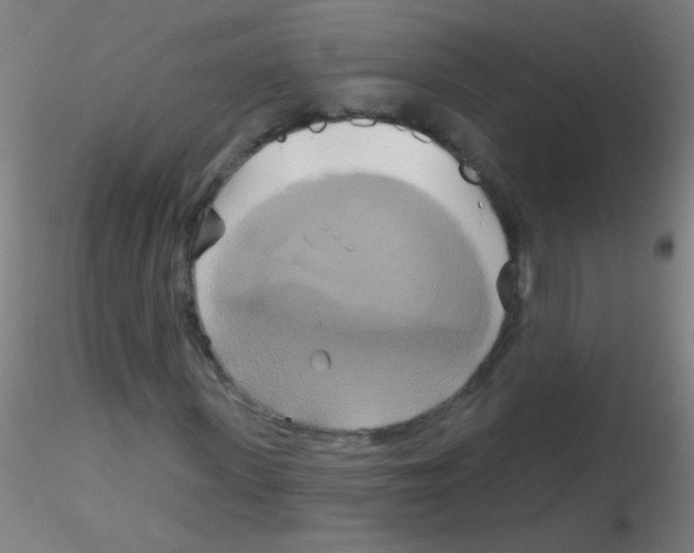 X0000115170915200911251330