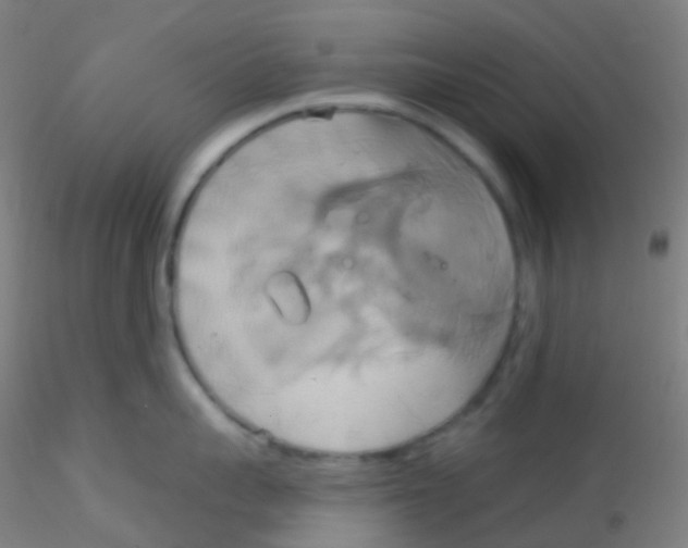 X0000115170959200911251331