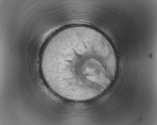 X0000115170979200911251330