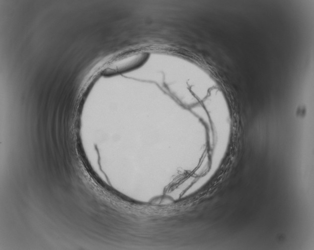 X0000115170007200912091034