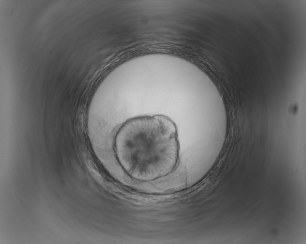 X0000115170036200912091034