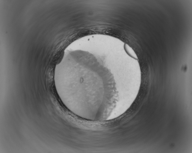 X0000115170040200912091034