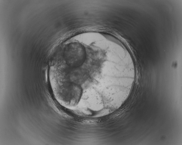 X0000115170061200912091033