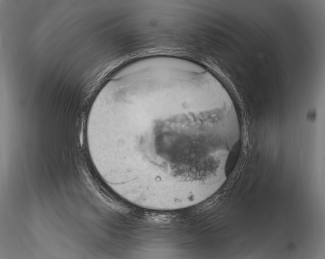 X0000115170062200912091033