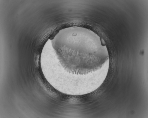 X0000115170070200912091033