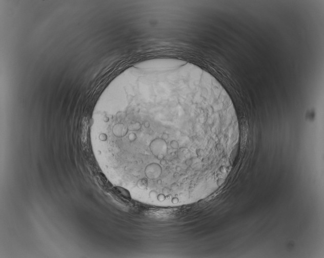 X0000115170078200912091033