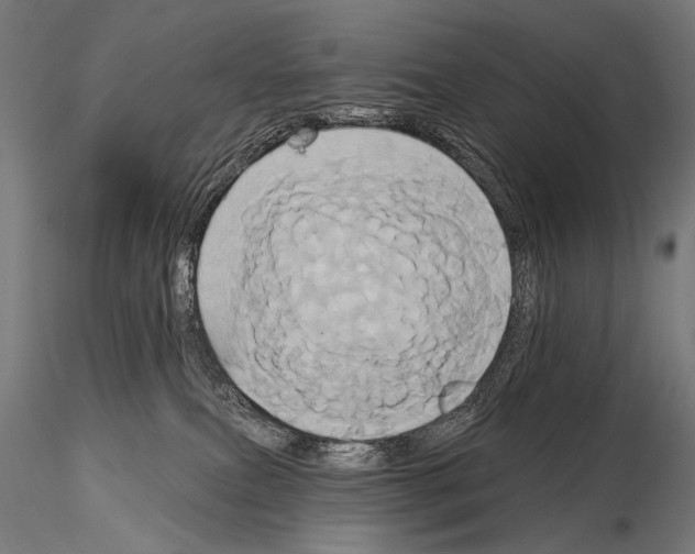 X0000115170087200912091033