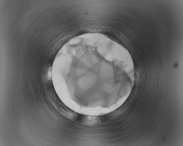 X0000115170095200912091033