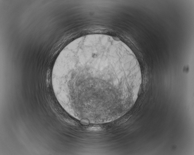 X0000115170119200912091032