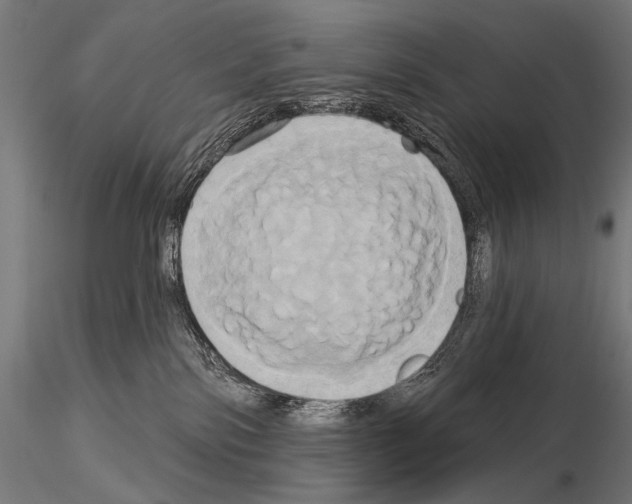 X0000115170138200912091032