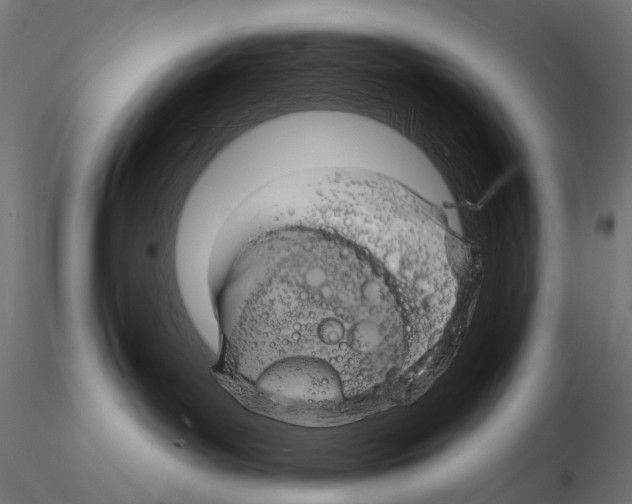 X0000115170143200912091032