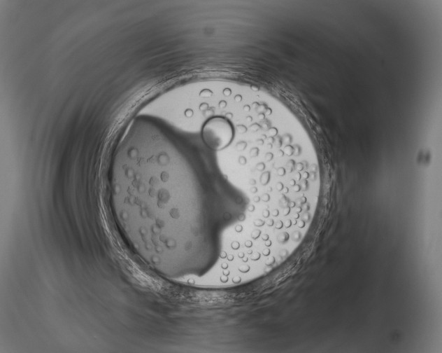 X0000115170145200912091031