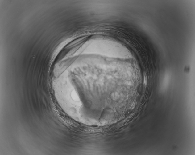 X0000115170147200912091031