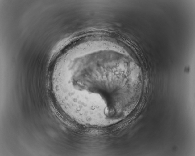 X0000115170149200912091031