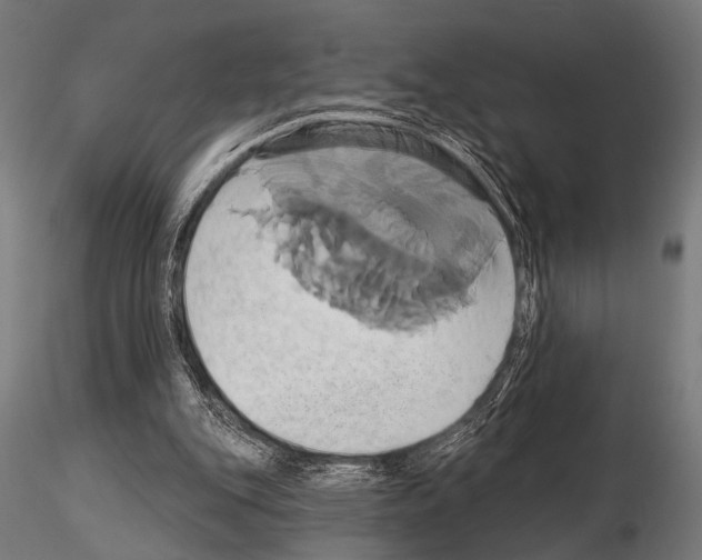 X0000115170151200912091031