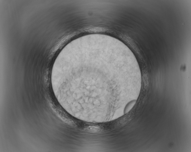 X0000115170159200912091032