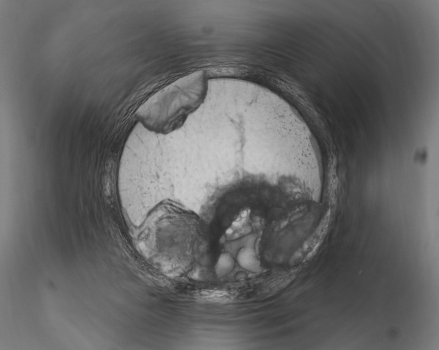 X0000115170161200912091032