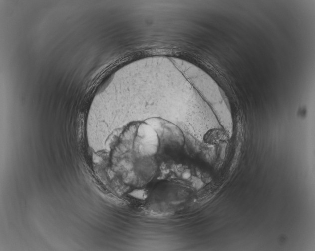 X0000115170165200912091032