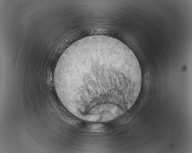 X0000115170173200912091032