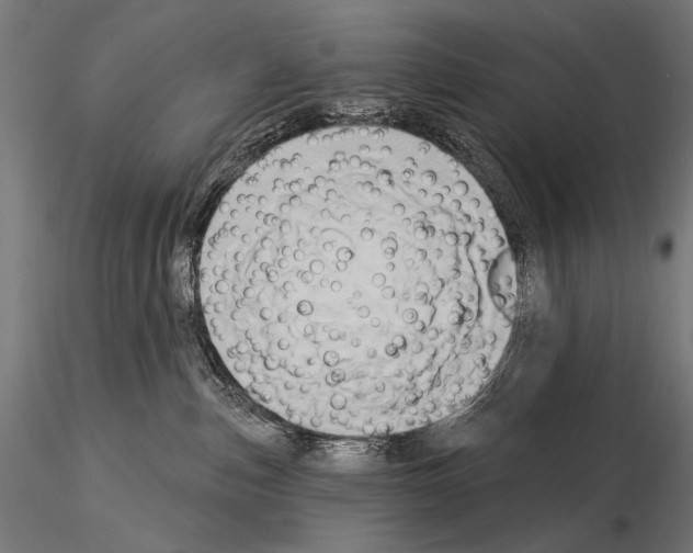 X0000115170187200912091032