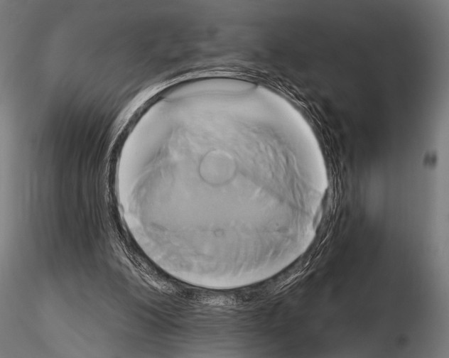 X0000115170200200912091031