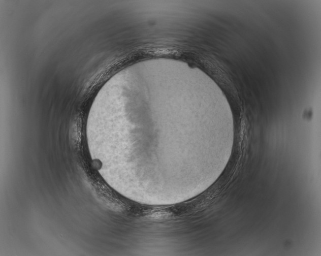 X0000115170210200912091031