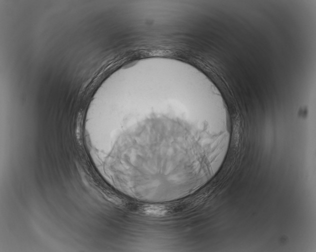 X0000115170214200912091031