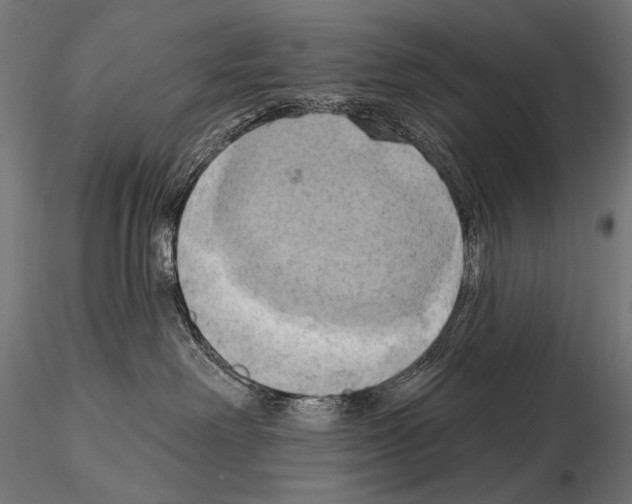 X0000115170238200912091031