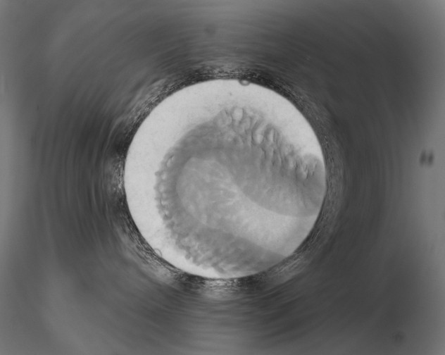 X0000115170240200912091031