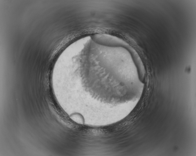 X0000115170250200912091030