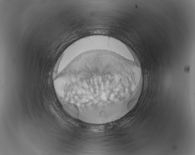 X0000115170263200912091030