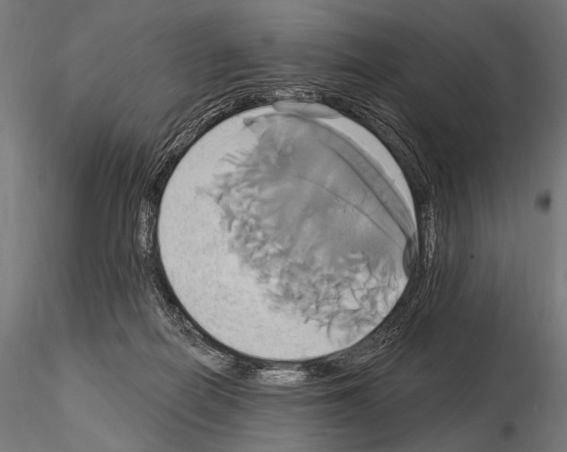 X0000115170266200912091030