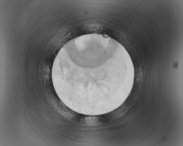 X0000115170279200912091031