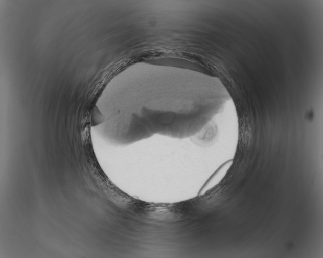 X0000115170285200912091031