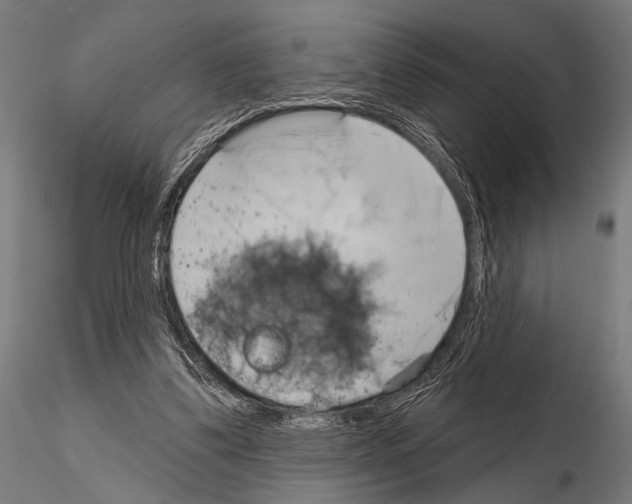 X0000115170299200912091030