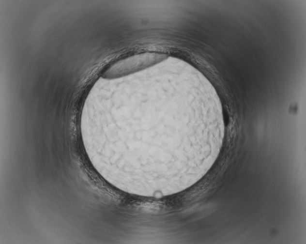 X0000115170306200912091030