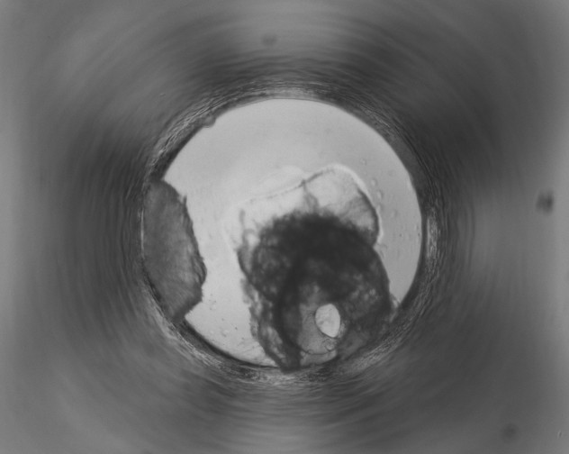 X0000115170349200912091029