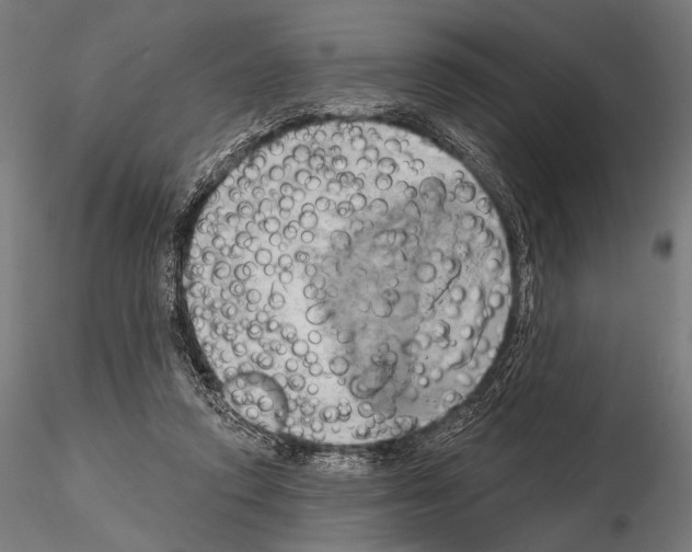 X0000115170354200912091029