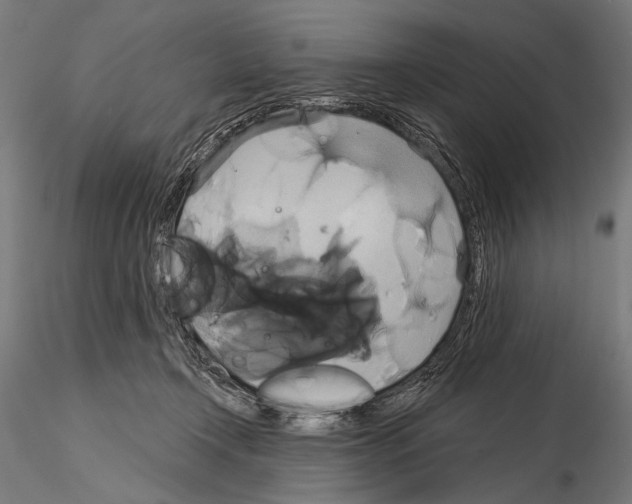 X0000115170366200912091029