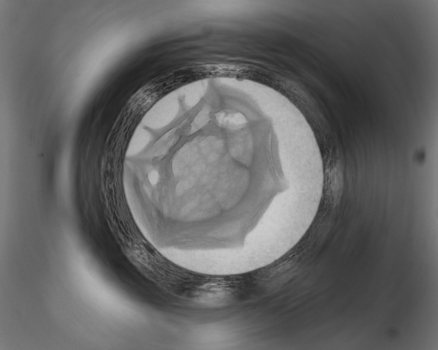 X0000115170381200912091029