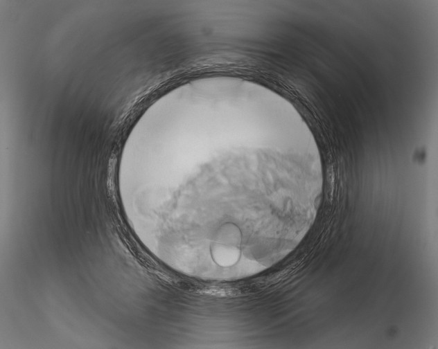 X0000115170404200912091028