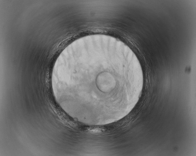 X0000115170407200912091028