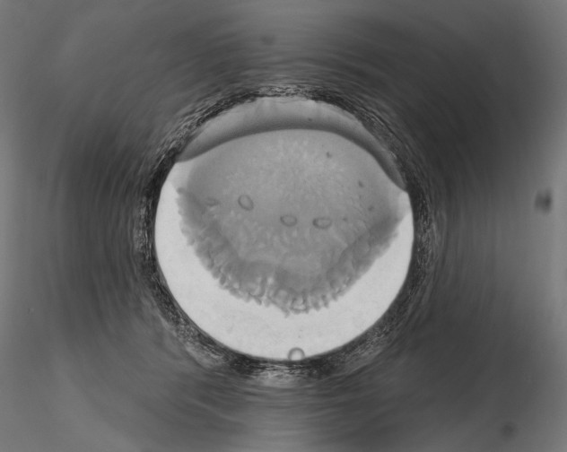 X0000115170416200912091028