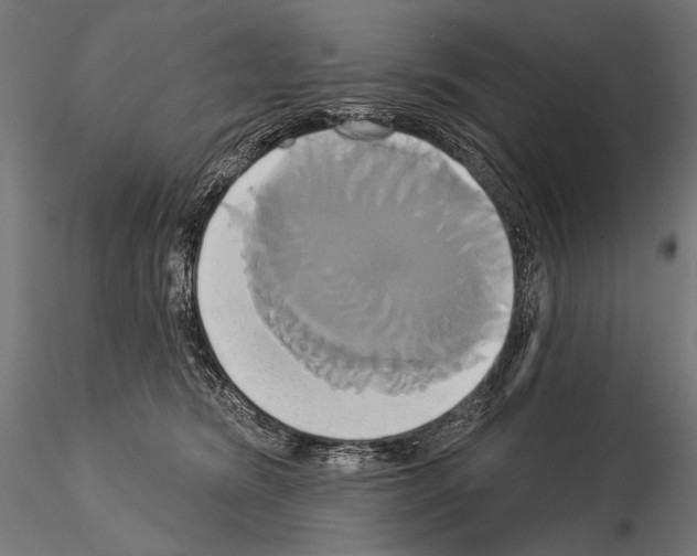 X0000115170420200912091028