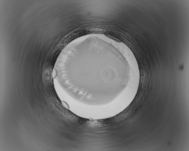 X0000115170425200912091028