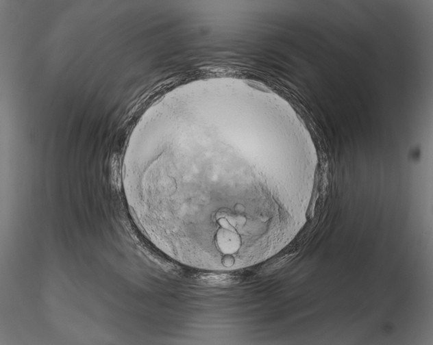 X0000115170428200912091028