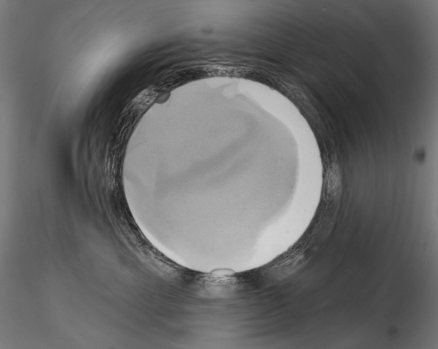 X0000115170429200912091028